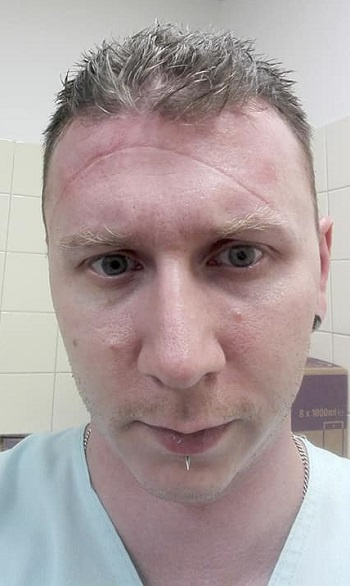 Jakub Tláskal po "odmaskování".