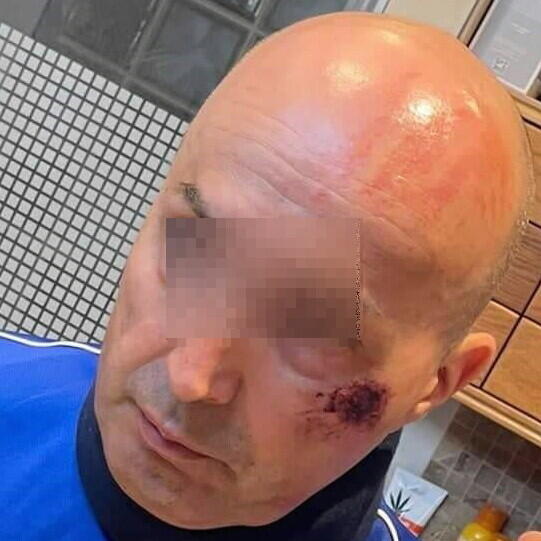 Zraněný cyklista, foto: PČR